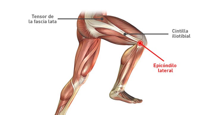 Rodilla del corredor: conoce cómo evitarla y tratarla