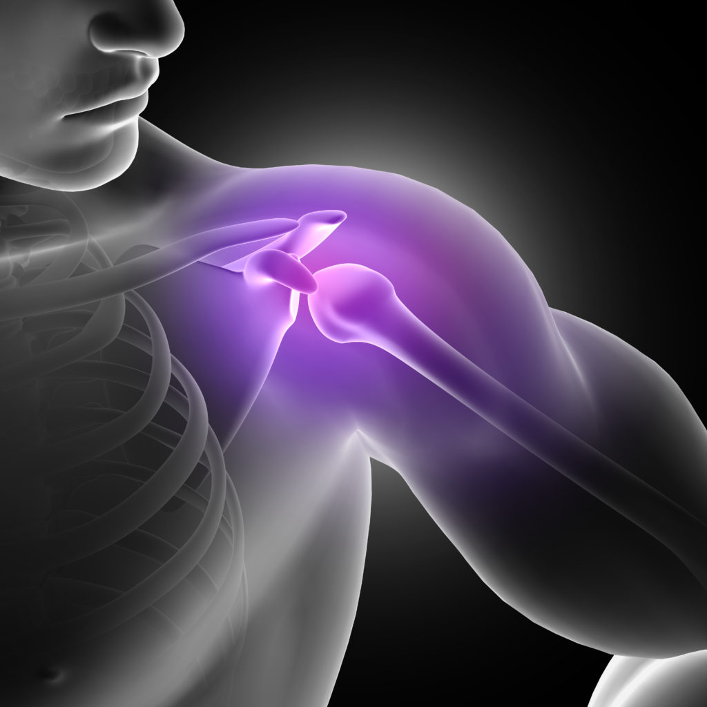 Tratamiento capsulitis adhesiva